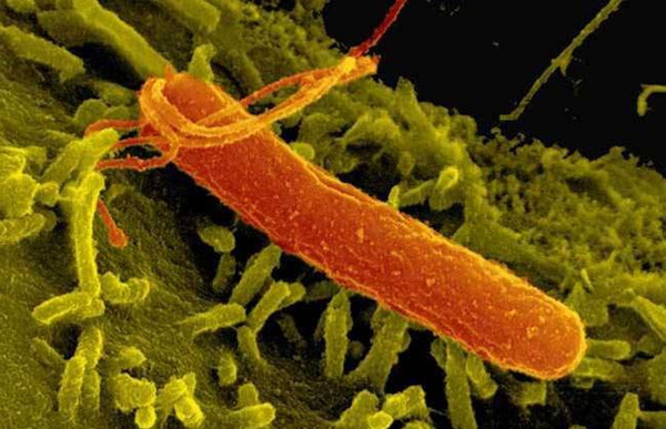 幽門(mén)螺旋桿菌